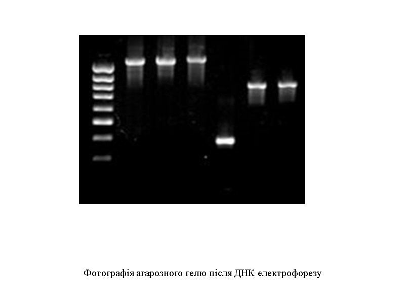 Фотографія агарозного гелю після ДНК електрофорезу